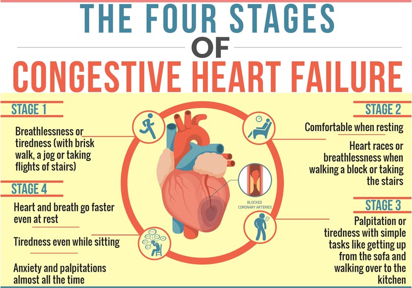 congestive heart failure stages