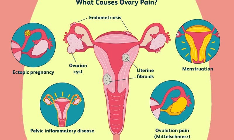 left ovary pain